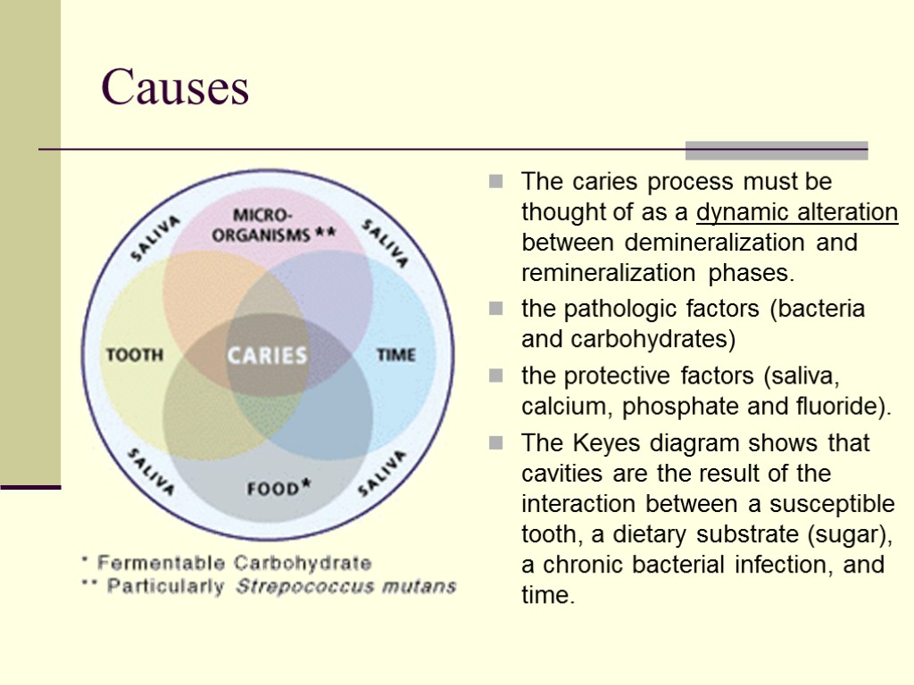 Causes The caries process must be thought of as a dynamic alteration between demineralization